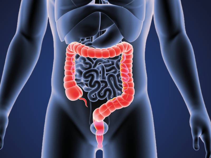 Colorectal Cancer | Colorectal cancer specialist in Pune - Dr Manoj Dongare