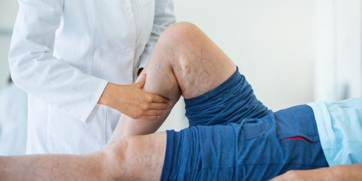 Is Laser Varicose Veins Treatment Painful? What Patients Should Expect | Dr. Lalit Banswal