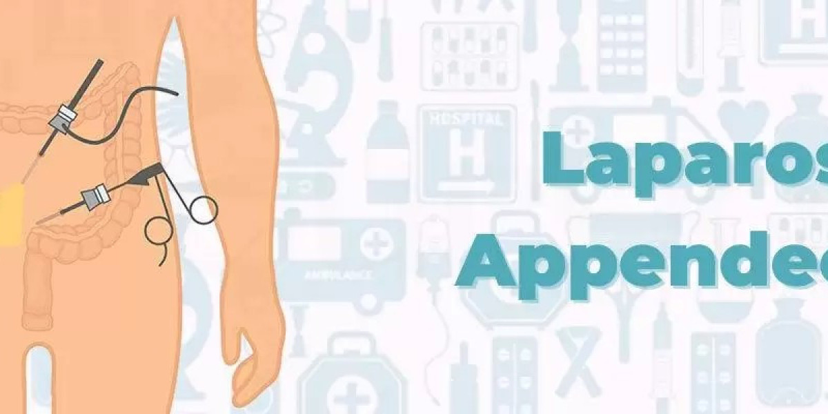 Laparoscopic Appendectomy - Dr. Samrat Jankar