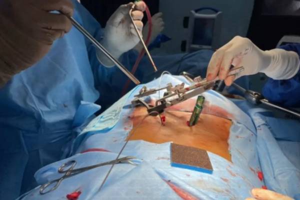 Best Spine Surgery in PCMC by Dr. Ashutosh Jadhav