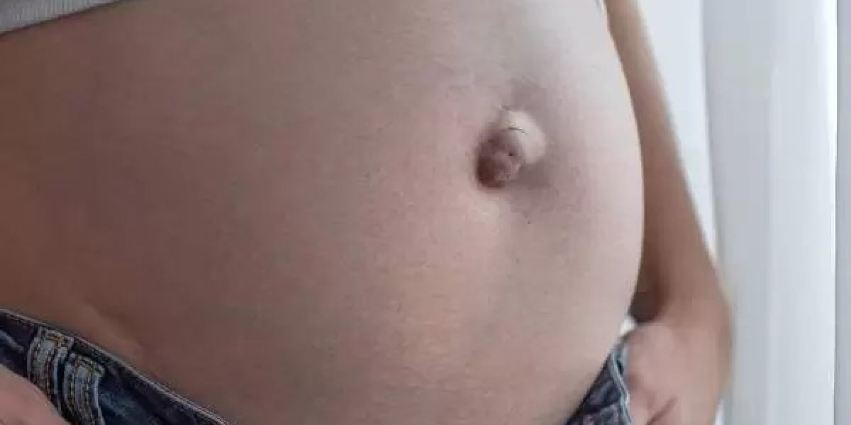 Advanced Umbilical Hernia Treatment in Pune, Maharashtra | Kaizen Gastro Care